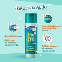 (ขวดใหญ่170ml.) น้ำตบ ฮาดะ ลาโบะ สูตร ลดสิว คุมมัน Hada Labo Blemish &amp;  Control Hydrating Lotion