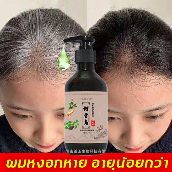 แชมพูสระผม-tgk-แชมพูปิดผมหงอก-แชมพูแก้ผมหงอก-แชมพูเหอโส่วอู-300ml-แชมภูปิดผมขาว-แก้ผมหงอกถาวร-แชมพูปิดหงอก-ผมหงอกกลับมาดำ-แก้ผมหงอก-แชมพูสมุนไพร-น้ำยาแก้ผมหงอก-แชมพูผมดกดำ-แชมพูขิง-แชมพูปิดผมขาว-เซรั่