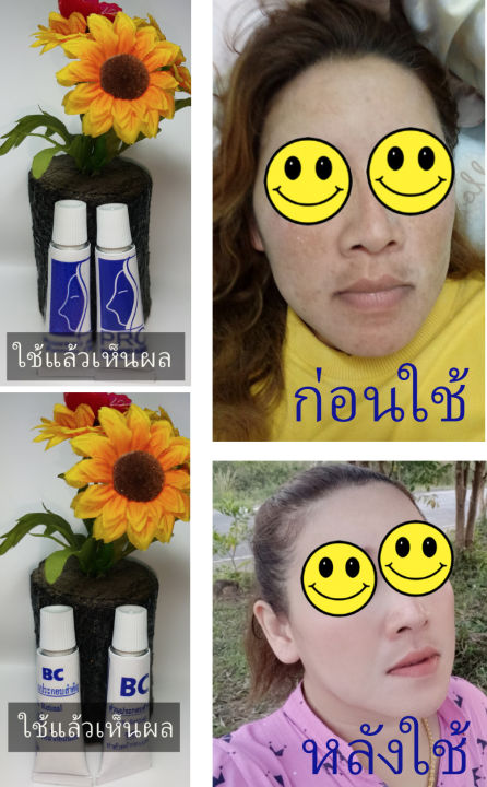 ครีมทาแก้ฝ้า-กระ-จุดด่างดำ-สูตรเข้มข้น-สำหรับฝ้ากระ-หนา-เดอร์ม่า-พรรณ-derma-pan