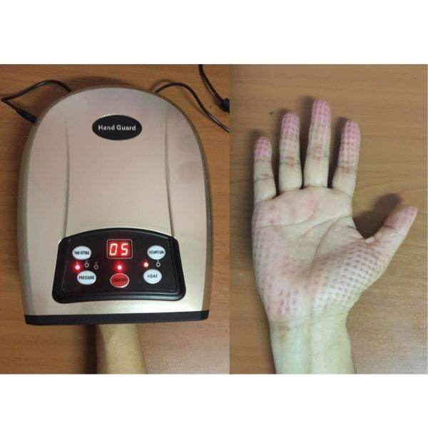 เครื่องนวดมือ-เครื่องนวดมือไฟฟ้า-เครื่องนวดมือแบบบีบ-เครื่องนวดมือคลายนิ้วล๊อค