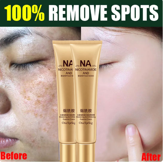 100 Effective And Original Whitening Freckle Cream Original Pekas Remover Freckle Removal