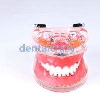 Dental Model Tools Typodont Teeth Model Adult Pathological Periodontal Disease 4017#