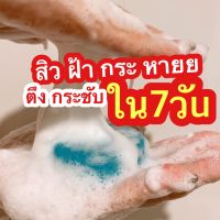 สบู่โบท็อกซ์ สบู่หน้าใส ปราบสิว กระชากฝ้า พิฆาตความดำ สลายความแก่ (**ไม่มีกล่อง) หมดแล้วหมดเลย!!