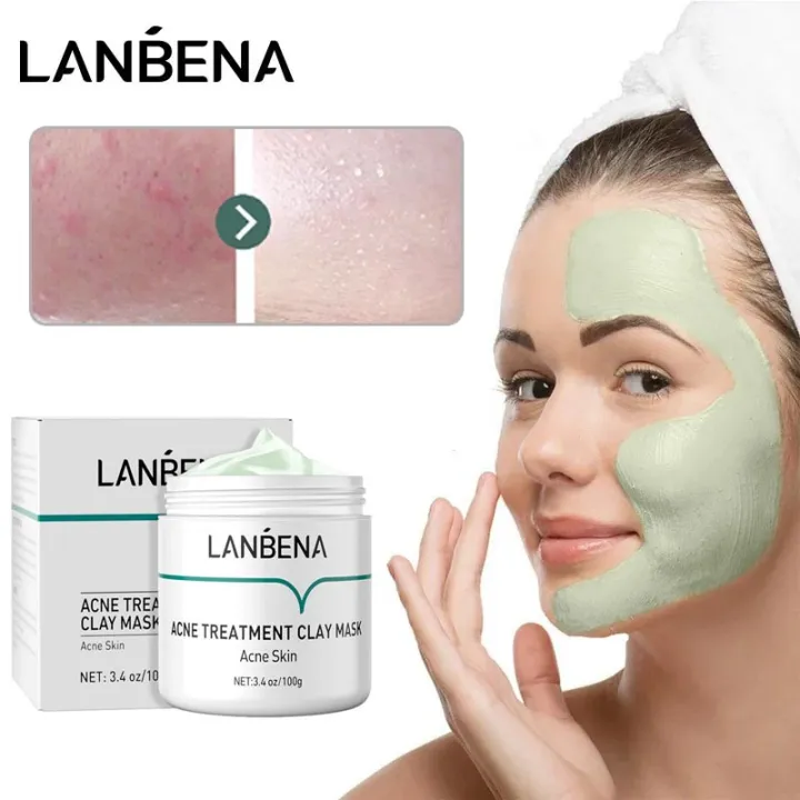 LANBENA Acne Treatment Clay Mask Oligopeptide Acne Masks Mud Face Cream