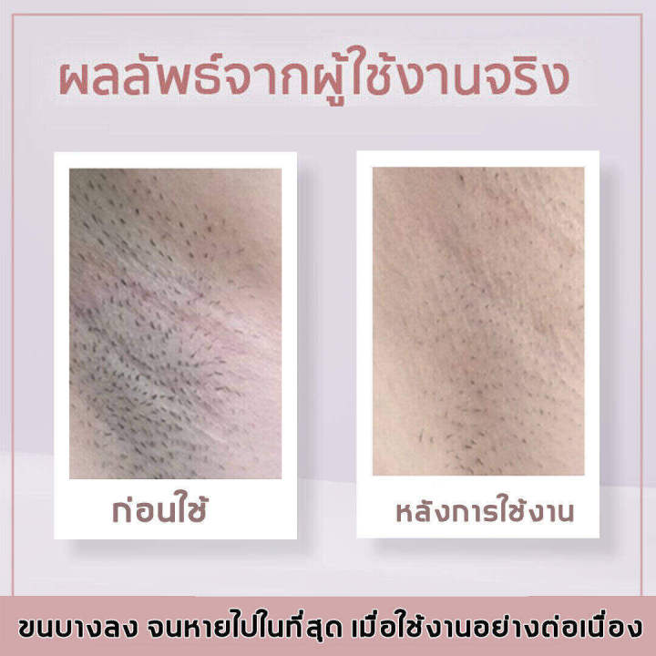 โกนได้อย่างหมดจดโดยไม่ทิ้งสารตกค้าง-เครืีองกำจัดขน-ที่โกนหมอยหญิง-ถอนขนไม่เจ็บ-ไม่ทำร้ายผิว-ใช้ได้ทุกส่วนของร่างกาย-1-วินาทีกําจัดขน-เครื่องโกนหมอย-เครื่องกำจัดขนบิกินี่-เครื่องถอนขน-ที่โกนขนที่ลับ-กำ