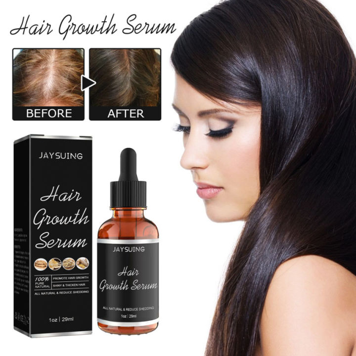 Fast Hair Growth Serum Anti Hair Loss Serum Prevent Baldness Treatment ...