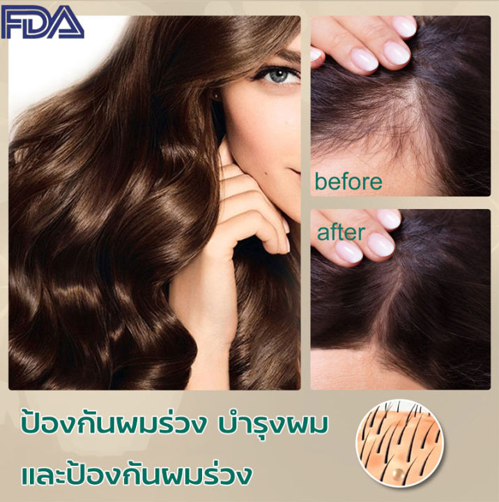 จัดส่งในวันเดียวกัน-สเปรย์ฉีดผมป้องกันผมร่วงแบรนด์-eelhoe-แบบ-100g-เซรั่มปลูกผม-ป้องกันผมร่วง-ลดผมร่วง-สเปรย์ปลูกผม-เร่งผมยาวไว-ยาปลูกผมของแท้-แก้ปัญหาผมร่วง-น้ำยาเร่งผมยาว-ครีมปลูกผม-เซรั่มเร่งผมยาว-