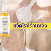 HYQINGล้างผิวสวยไร้ไรฝุ่น  ครีมอาบน้ำ 260ML โฟมเยอะ อ่อนโยนไม่ระคายเคือง ยับยั้งไร ลบสิว ป้องกันผิวแห้งกร้าน ล้างให้มีผิวสวยใสไร้สิวออกมา บอกลาผิวหยาบกร้าน（เจลอาบน้ำ/ครีมอาบน้ำ/สบู่อาบน้ำครีมอาบน้ำ/โฟมเยอะ/เจลอาบน้ำซากุระ/โฟมโมเลกุลเล็ก）