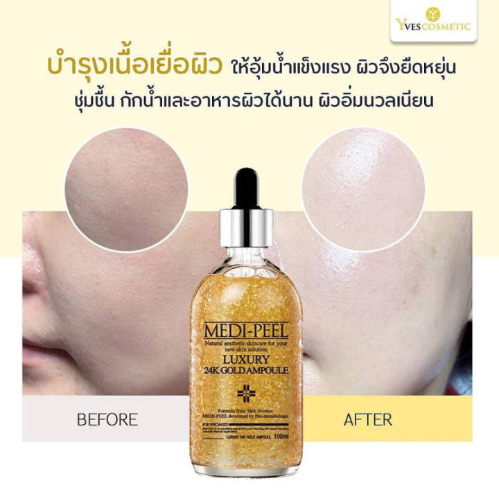 medipeel-gold-24k-ampoule-100ml-เซรั่มทอง-ผิวชุ่มชื้น-ผิวอ่อนเยาว์-ผิวกระชับ-ผิวแน่น