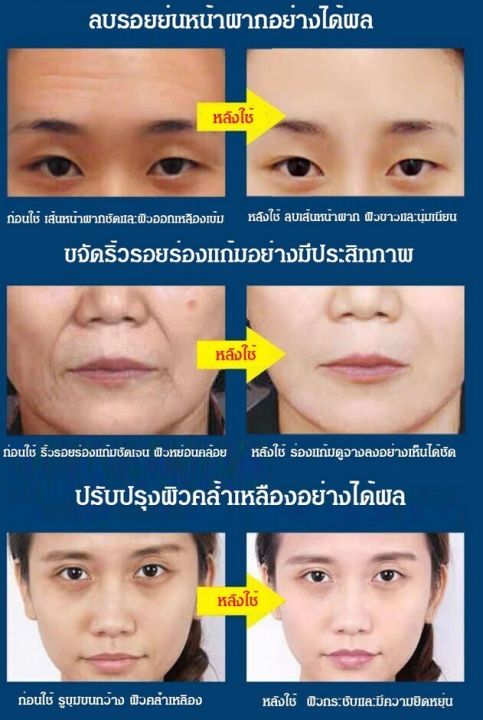 juscomart-ครีมฟื้นฟูผิวต่อต้านริ้วรอยสำหรับผู้หญิงให้ความชุ่มชื้นแก่ผิวและขจัดริ้วรอย