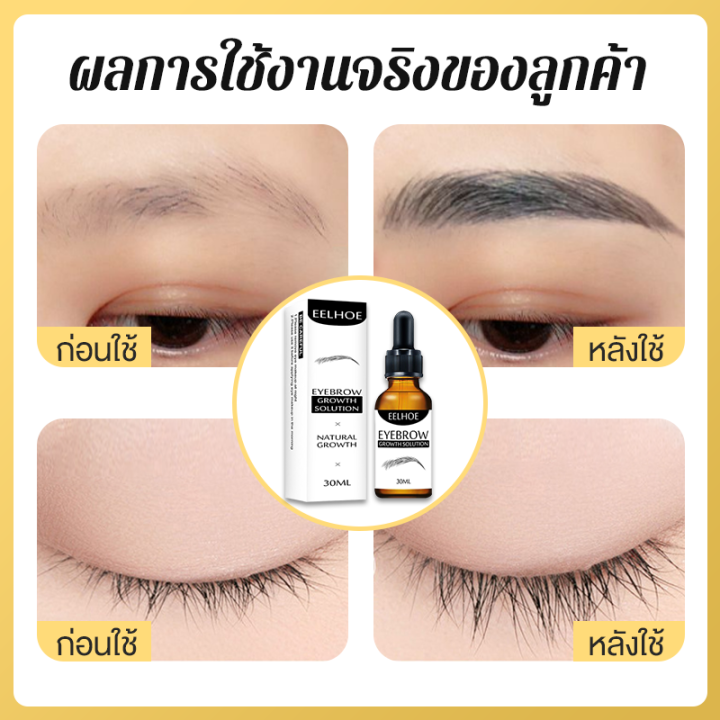 eelhoe-เชรั่มปลูกคิ้ว-เซรั่มปลูกคิ้ว-30ml-น้ำยาปลูกคิ้ว-การเจริญเติบโตของคิ้วจริง-ทำให้หนาและเข้มขึ้น-บำรุงล้ำลึก-อ่อนโยนและไม่ระคายเคือง-ครีมปลูกคิ้ว-น้ำยาเร่งคิ้ว-ปรูกหนวด-ปลูกคิ้ว-การเติบโตของคิ้ว-