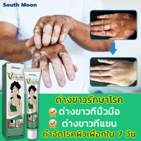 ?7วัน เห็นผล?South Moon ครีมทาด่างขาว 20g สารสกัดจากสมุนไพร ไม่ระคายเคือง ใช้ได้ทั้งร่างและทุกวัย ผลิตภัณฑ์กระตุ้นการสร้างเม็ดสีของผิว โรคด่างขาว โรคผิวหนัง ผลิตภัณฑ์ Vitiligo ด่างขาวที่หน้า ด่างขาวที่หลัง ด่างขาวที่แขน ด่างขาวที่ขา ยาด่างขาว