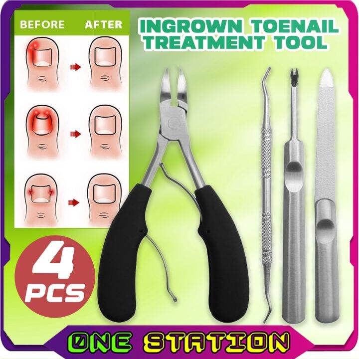INGROWN TOENAIL TREATMENT TOOL 4PC/SET CORRECTOR CLIPPER LIFTER KIT ...