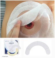 40 PCS Ostomy Care Hydrocolloid Tape Portable fixed tape for Colostomy Bags Prevent flange warping and shifting for sport