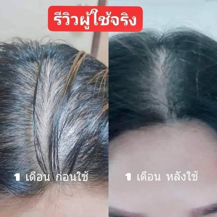 แชมพูสมุนไพรคุณยาย-250-มล-แชมพูลดผมร่วง-ผมมันง่าย-คันศรีษะ-รังแค-ลูกผมขึ้น-หัวไม่ล้าน