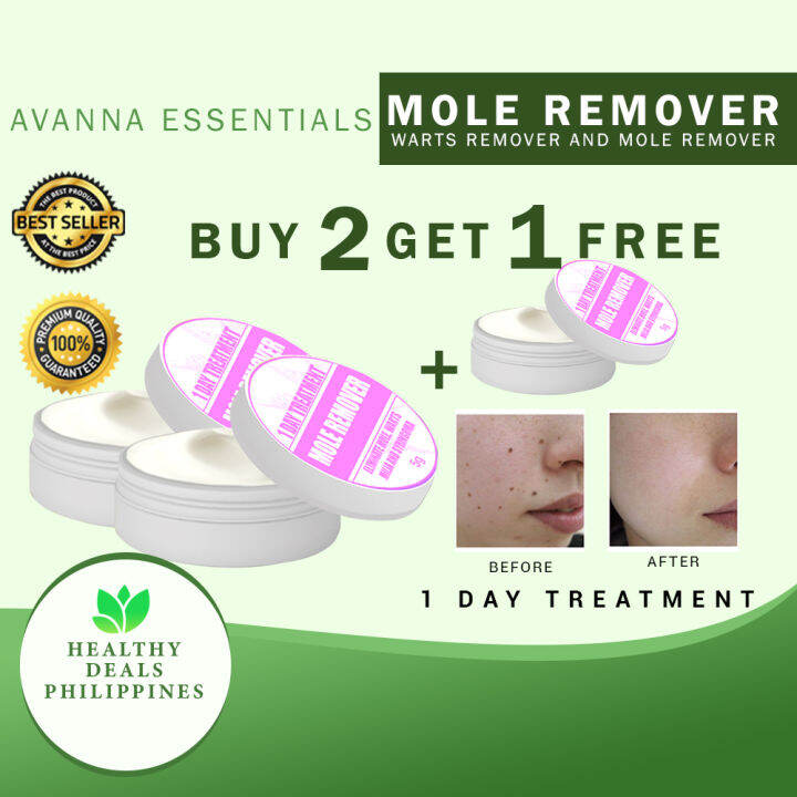 Buy Get Free Of Orig Avanna Essentials Warts Remover Kasoy Cream Warts Remover And Mole