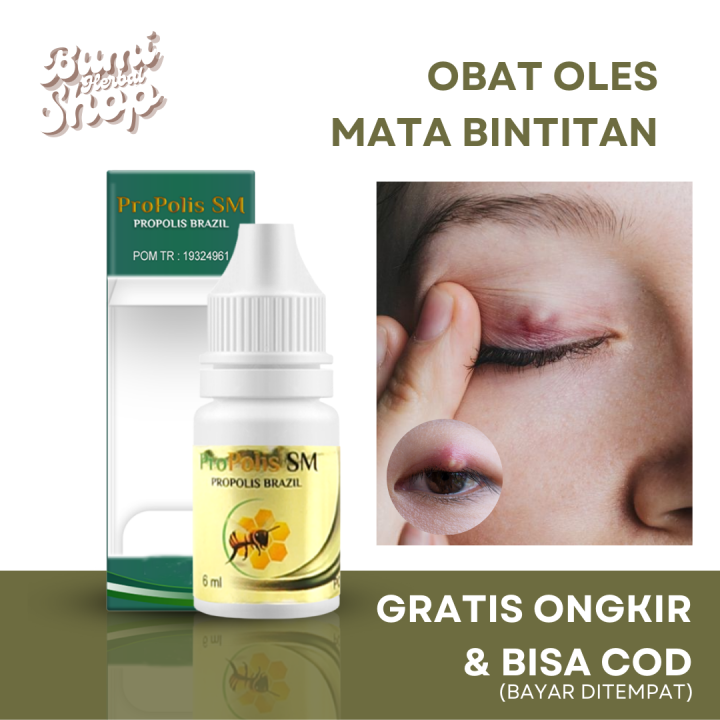 Obat Salep Pengempis Mata Bintitan / Kalazion, Obat Oles Penghilang ...