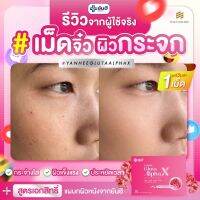 Gluta Alpha ยันฮีกลูต้า ยันฮีปฏิวัติปัญหาผิว