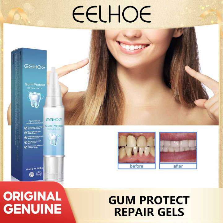 Eelhoe Gum Repair Gel Rebuilding Strengthen Whiten Remove Tooth Stains