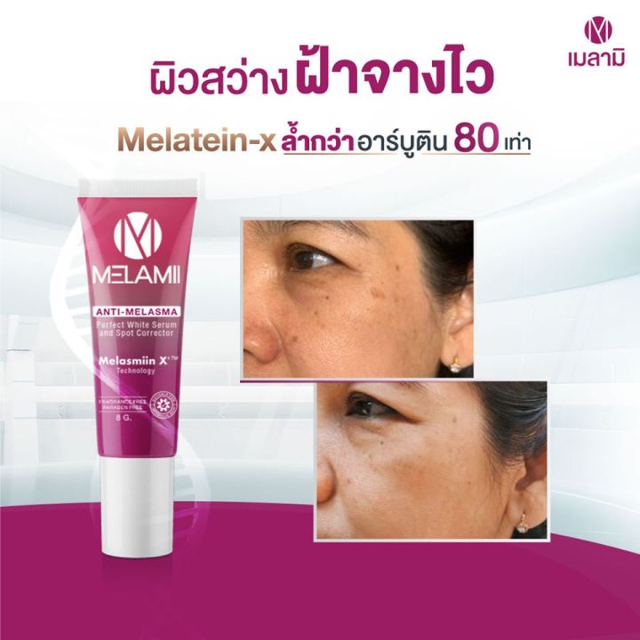 ครีมทาฝ้า-เมลามิ-ลดฝ้า-กระ-จุดด่างดำ-melamii-anti-melama-perfect-white-serum-ลดฝ้า-กระ-ผิวใสใน-7-วัน-ใช้ต่อเนื่อง-ไม่แพ้-ไม่ดื้อยา