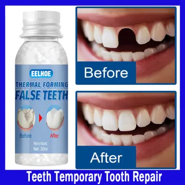 Solid Teething Gum Temporary Tooth Kit Repair Teeth Gaps Filling