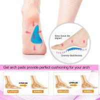 Silicone Orthopedic Insoles for Shoes Women Feet OX Plate Flat Foot Corrector Shoe Cushion Orthotic High Arch Support Insoles