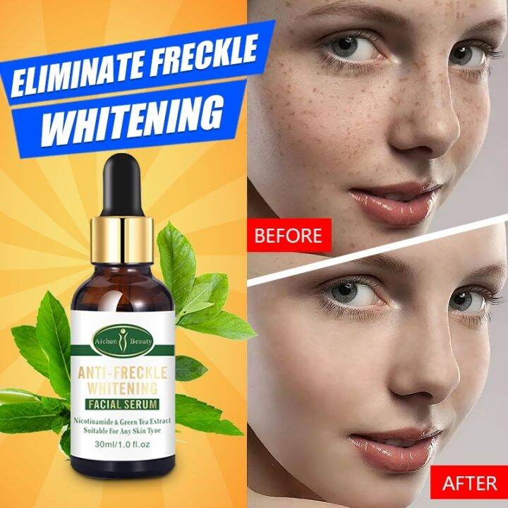 Dark spot remover Serum for dark spots Face whitening Hyperpigmentation
