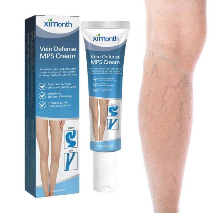 Varicose Vein Cream For Legs Remove With Plant Ingredients Suitable For