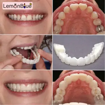 Fake Braces for Teeth 