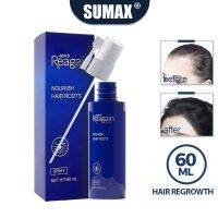 ?สินค้าขายดี? [60ml]SUMAX โลชั่นเร่งผมยาว  ป้องกันผมร่วง ผมมัน ผมชี้ฟู บำรุงรากผม