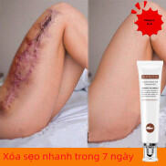 Kem xóa sẹo, chăm sóc da sẹo, phục hồi cho da mặt, phục hồi sẹo bỏng