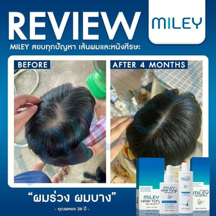 ฟรี-1-แถม-1-miley-มิลเล่-แฮร์-แชมพู-โทนิค-เปปไทด์จากสเต็มเซลล์-เร่งผมยาว-ผมร่วง-ผมบาง-คันรังแค-ผมแห้งเสีย-by-skin-agem-korea