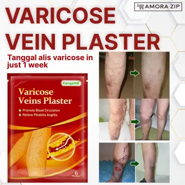 Shop Compression Stockings For Varicoes Veins with great discounts