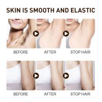 ZZOOI Permanent Hair Removal Spray Natural Painless Armpit Leg Arm Hair Remover Hair Growth Inhibitor Nourish Repair Body Care 30ml