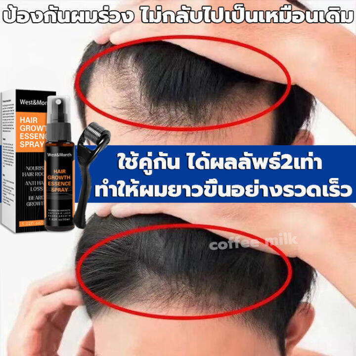 ทำให้ผมยาวขึ้นอย่างรวดเร็ว-สเปรย์ปลูกผม-30ml-ลูกกลิ้ง-ใช้คู่กัน-ได้ผลลัพธ์2เท่า-ป้องกันผมร่วง-ปลูกผมเร่งด่วน-ยาปลูกผม-น้ำยาใส่ผม-เซรั่มปลูกผม-น้ำยาเร่งผมยาว-ปลูกผม-ยาปลูกผมของแท้-hair-growth