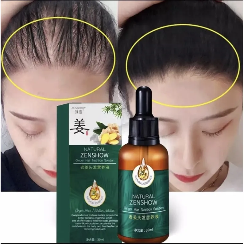 Buy Days Fast Hair Growth Care Solution Ginger Hair Growth Essence Nourish And Soften Hair Loss And Repair Damaged Hair 30ml |Hair Care Essential Oil Solution-Fordeal | Fast Hair Growth Serum Ginger Buy Days Fast Hair Growth Care Solution Ginger Hair Growth Essence Nourish And Soften Hair Loss And Repair Damaged Hair 30ml |Hair Care Essential Oil Solution-Fordeal | Fast Hair Growth Serum Ginger