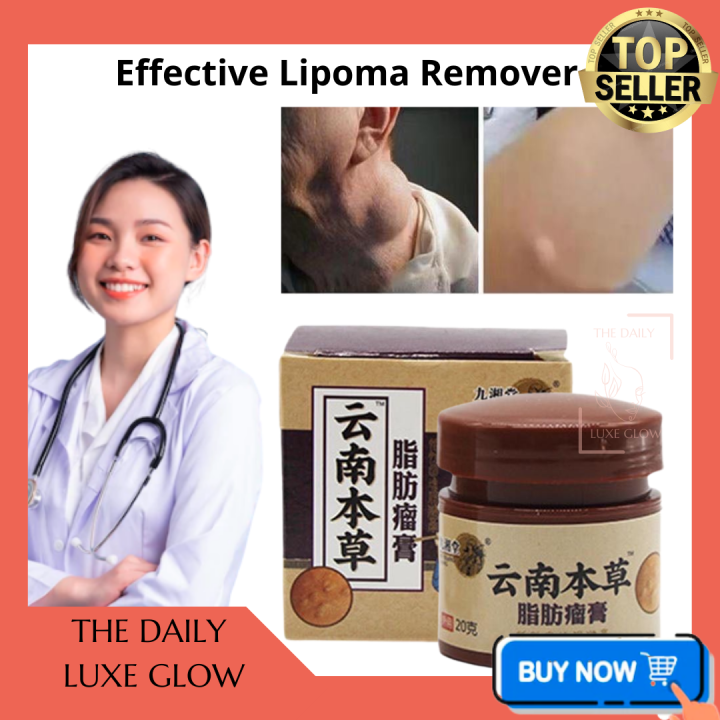 10x Effective Lipoma Remover Cream Original Herbal Lipoma Removal Cream ...