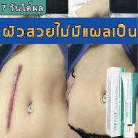 (เหมาะสำหรับแผลเป็นเก่าและใหม่)BREYLEE ครีมทารอยแผลเป็น ครีมลดรอยแผลเป็น 30 กรัม ยาทาคีลอยด์ ครีมลดรอยแผลเป็น ยาทาแผลผ่าคลอด ยาทาแผลผ่าคลอด