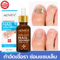 【ผู้ขายในท้องถิ่น】Aliver เซรั่มบำรุงเล็บ 30ML ลากับเล็บเสีย ไม่ทำร้ายเล็บดี ห่างกับปัญหาเล็บ (เชื้อราที่เล็บ ยาทาเชื้อราที่เล็บ ยาแก้เล็บขบ เชื้อราเล็บมือ ครีบบำรุงเล็บ เซรั่มเชื้อราเล็บ น้ำยาเล็บขบ) nail fungus