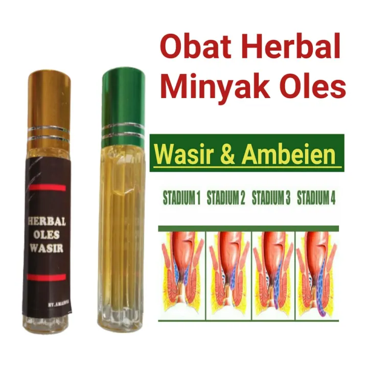 Minyak Oles Untuk Wasir Ambeien Luar Dalam Obat Herbal Hemoroid Internal Eksternal Alami Lazada Indonesia