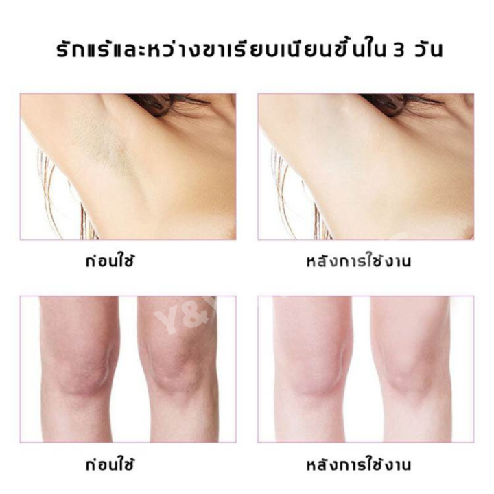 ครีมทารักแร้ดำ-ครีมคอดำ-pretty-cowry-ครีมคอขาว-ครีมรักแร้ขาว-เมลานินเจือจาง-ครีมขาขาว-ครีมขาหนีบดำ-ครีมขาหนีบขาว-ขาหนีบดํา-ครีมทาง่ามขาดำ