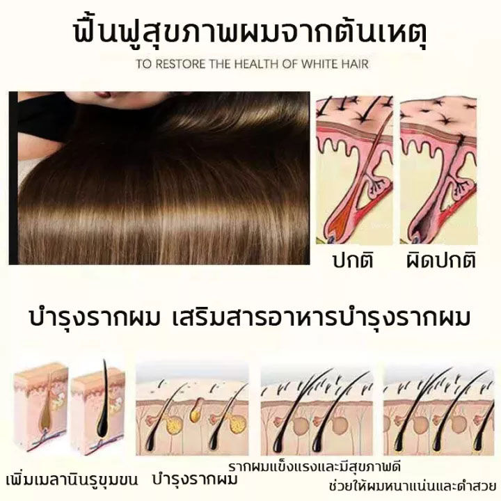 พร้อมส่ง-anyichun-แชมพูปิดผมหงอก-แชมพูแก้ผมหงอก-แชมพูเหอโส่วอู-300ml-แชมภูปิดผมขาว-my-organic-แก้ผมหงอกถาวร-แชมพูปิดหงอก-ผมหงอกกลับมาดำ-แก้ผมหงอก-แชมพูสมุนไพร-น้ำยาแก้ผมหงอก-แชมพูผมดกดำ-เซรั่มลดผมหงอก