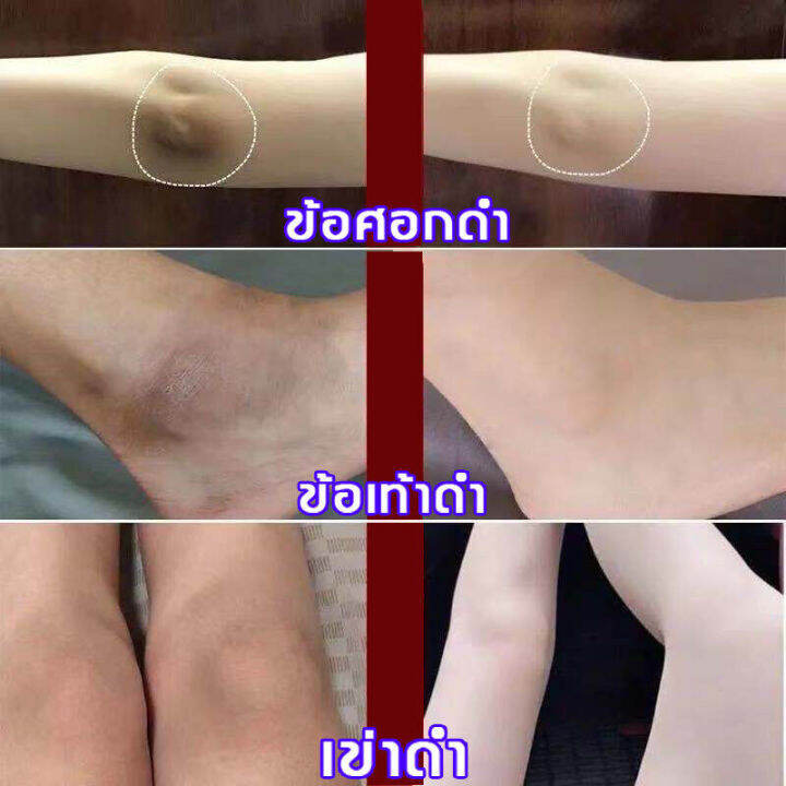 aichun-สบู่ก้อน-สบู่ผิวขาว-สบู่หน้าขาวใส-สบู่ไพรเย็น-ครีมคอขาว-กระชับ-และฟื้นฟูผิว-ชุ่มชื้น-เมลานินเจือจาง-ปรับปรุงความหมองคล้ำ-ไวท์เทนนิ่งโซป-สบู่แฮนด์เมด-ครีมรักแร้ขาว-ครีมทารักแร้ดำ-ครีมทาคอดำ-ครีม