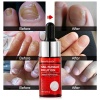 Vibrant glamour dưỡng móng tay dài và cứng nail repair serum fungal nail - ảnh sản phẩm 2