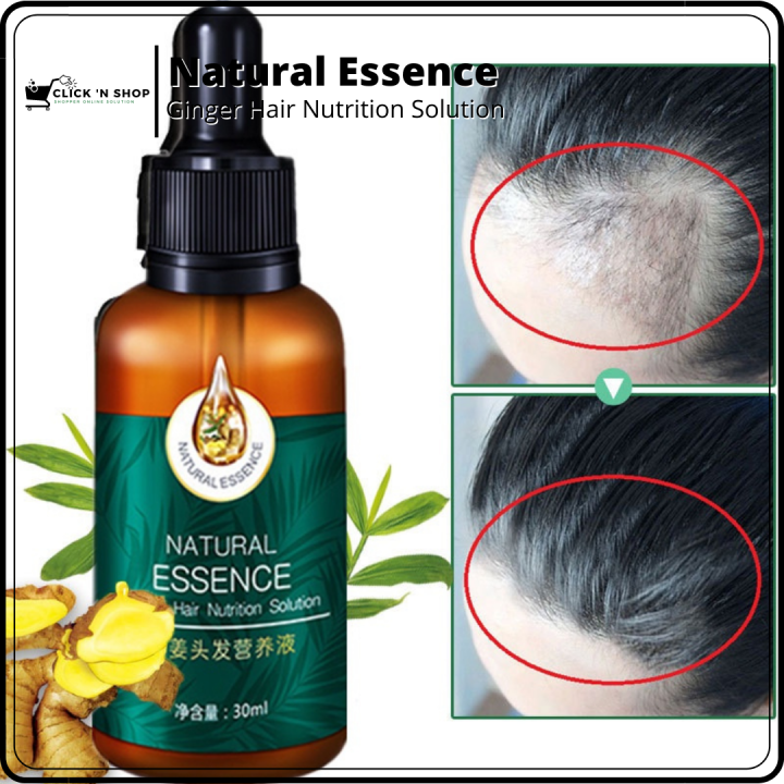 Hair Serum Hair Grower Fast Long Hair Loss Treatment Minoxidil Castor