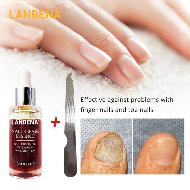 lanbena-nail-repair-essence-serum-fungal-nail-treatment-remove-onychomycosis-toe-hand-foot-skin-care