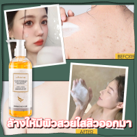 ขจัดไร Mite Eliminating Ac ป้อวกันสิวขึ้น ชุ่มชื่นซ่อมแซมและบำรุง HYQING ครีมอาบน้ำ 260ML [บอกลาสิวหน้าอกและหลัง] ป้องกันผิวแห้งกร้าน ลบสิว ครีมอาบน