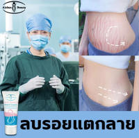 AICHUNครีมกันแตกลาย ครีมลดรอยแตกลาย ครีมทาท้อง ครีมทาท้องลาย60กรัม แก้แตกลาย ครีมแก้ท้องแตกลาย ครีมแก้ท้องลาย ลดผิวแตกลาย ครีมลดรอยแตก ค