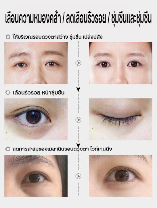 caviar-essence-eye-cream-15g-precious-caviar-essence-ครีมบำรุงรอบดวงตา-ครีมบำรุงรอบดวงตาส่วนล่าง