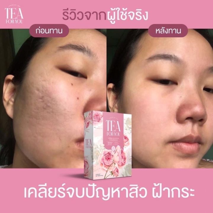 พร้อมส่ง-ชาชงตราอารยา-ผิวหน้าใส-ไร้สิว-ฝ้ากระจุดด่างดำจางลง-เห็นผล100